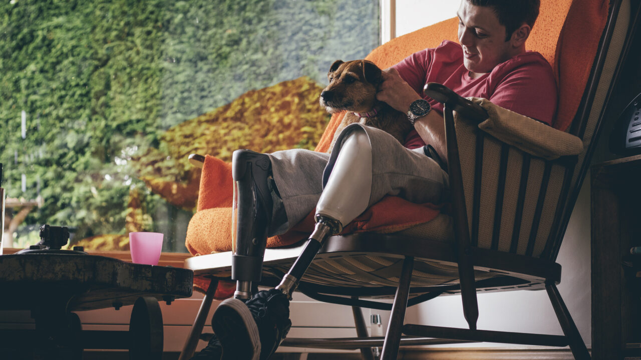 https://watsoncarroll.com/wp-content/uploads/2021/05/Prosthetic-leg-2-1280x720.jpg